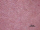 5 - Cellule corticali in visione superficiale